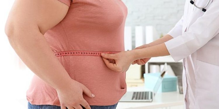 Obezite Cerrahisi Hakkında Doğru Bilinen 9 Yanlış